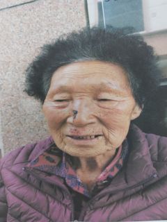 석봉시(84세) 여자